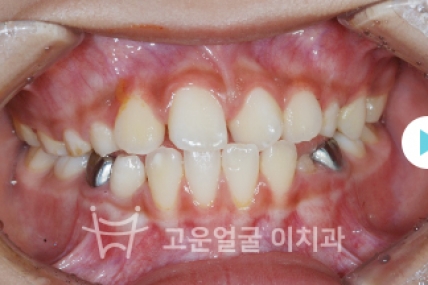 치료후기 이미지